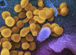 Proteína de pico SARS-CoV-2