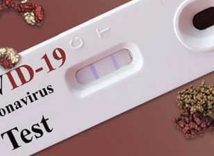 Rendimiento de la prueba de serología autorizada por la EUA